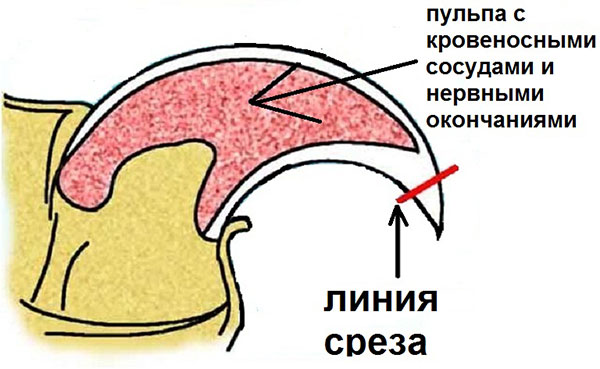 Как подстричь когти кошке. Линия среза